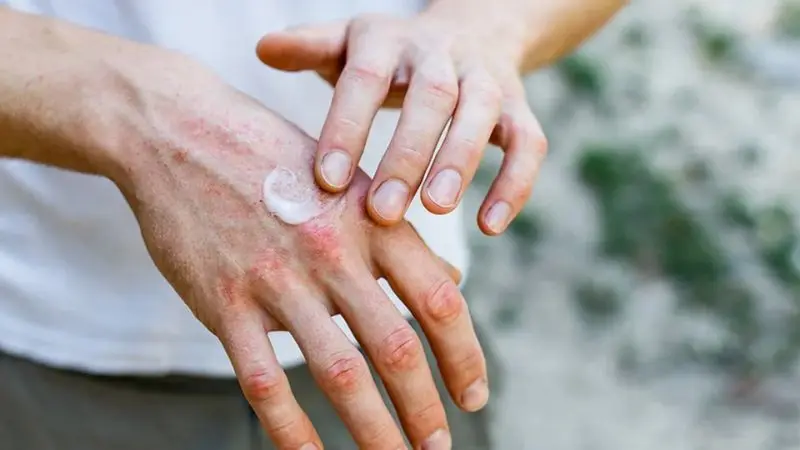 how to remove spray paint from nails 